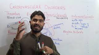 Cardio Vascular Disorders Thrombus Embolus Atherosclerosis Heart Attack Angina Pectoris and Stroke [upl. by Ahcsap]