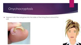 Recognize Non Infectious Nail Diseases [upl. by Atnahs]