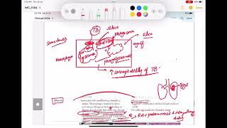 Pneumoconiosis Asbestosis Silicosis Berylliosis coal work Respiratory 42 First Aid USMLE Step1 [upl. by Bj]