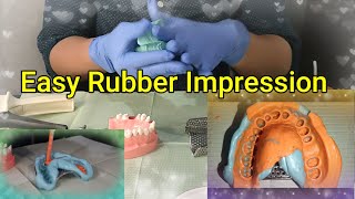 EASY Rubber Impression wo an Assistant A Dental Students Guide [upl. by Doreg]