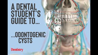 ODONTOGENIC CYST ODONT ACADEMY OF LEARNING 8497888181 [upl. by Rhianon]