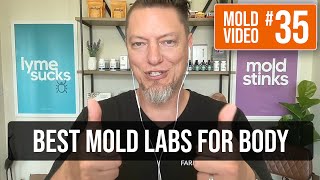 Which labs should I start with for mold [upl. by Ruphina352]