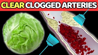 Top 7 BEST Vegetables To CLEAN Arteries And PREVENT Heart Attack Vitality Solutions [upl. by Ado248]