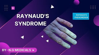 Raynauds Disease  WITH EASY NOTES FULL EXPLANATION IN HINDI BY NG MEDICALS [upl. by Mannos]