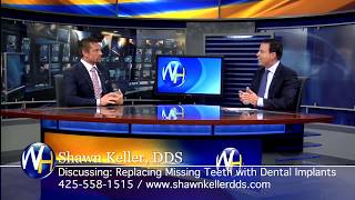 All ON 4 Dental Implants with Kirkland WA Dentist Shawn Keller DDS [upl. by Misti]