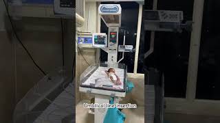 Umbilical line insertion hospital trending hospitaldoctor doctor hospitalist doctorshospital [upl. by Ayenet]