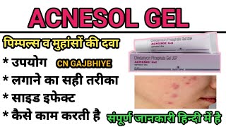 How to use Acnesol Gel Acnesol gel uses Side effects in hindi CNGAJBHIYE acnesolgel [upl. by Opiak]