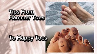 How to Promote Healing Hammer Toes  Acupressure amp Exercises [upl. by Tnilk620]