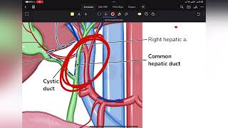 portal hypertension [upl. by Nabalas390]