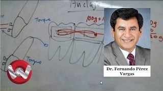 ¿Que es anclaje en ortodoncia [upl. by Inttirb]