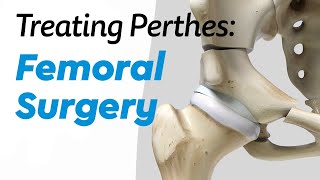 Femoral Surgery for Treating Perthes Disease in Children [upl. by Colson]