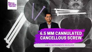 65mm Cannulated Cancellous Screws Related Instruments amp Uses [upl. by Dray]