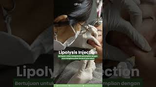 LIPOLYSIS INJECTION [upl. by Gambell]