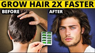 Grow Hair 2x Faster  Hair Growth Tips For Men  हिंदी में [upl. by Niveb]