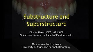 Implant Supported Substructure and Superstructure [upl. by Ellenhoj]