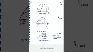 Épanchement pleural et ponction pleurale [upl. by Kirtap]