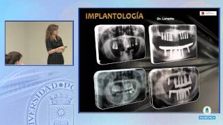 SFCM 1011 16 PUESTA AL DÍA DE TRES MATERIALES DE USO DIARIO EN ODONTOLOGÍA [upl. by Nniw]