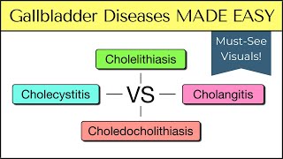 Cholecystitis vs Cholelithiasis vs Cholangitis vs Choledocholithiasis Nursing USMLE [upl. by Apoor794]