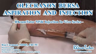 OLECRANON BURSA ASPIRATION  INJECTION  InVivo Series [upl. by Aratal]