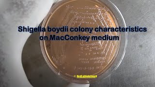 Shigella boydii colony characteristics on Macconkey medium Demonstrations [upl. by Fairlie968]