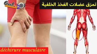 تمزق عضلات الفخذ الخلفية  déchirure musculaire  muscle tear [upl. by Inama]