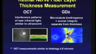 Optical Coherence Tomography OCT and neuroprotection [upl. by Acemat372]