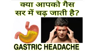 गैस की वजह से सर में दर्द GASTRIC HEADACHE AND HOMEOPATHY [upl. by Nonnaer]