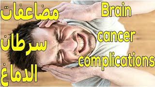 ما هى مضاعفات سرطان الدماغ ؟  What are the complications of brain cancer [upl. by Biddie]