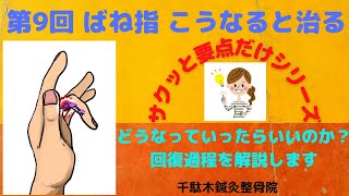 第９回 ひどいばね指 こうなってくると治ります 改善までの3つのステップ [upl. by Ggerg]