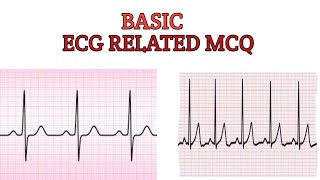 ECG Related Basic Multiple Choice Questions [upl. by Ardekahs868]