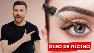 ÓLEO DE RÍCINO para seus olhos BLEFARITE CATARATA GLAUCOMA OLHOS SECOS INCHAÇOS [upl. by Annirtak429]