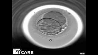 Time Lapse Embryo Imaging [upl. by Cataldo]