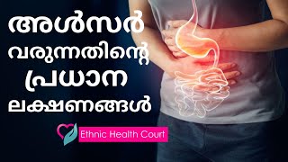 അൾസർ വന്നാൽ ശരീരം കാണിച്ചുതരുന്ന ലക്ഷണങ്ങൾ Symptoms of an Ulcer  Ethnic Health Court [upl. by Seligmann682]