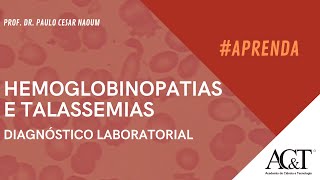 Diagnóstico Laboratorial das Hemoglobinopatias e Talassemias [upl. by Kiele]