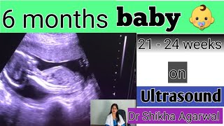 6th month baby on ultrasound Baby development [upl. by Oznol]