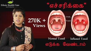 அடிநாக்கு சதையில் அழற்சி  டான்சில் நோய்  Tonsillitis  Immunity  Cure  DrYoga Vidhya [upl. by Nalda]