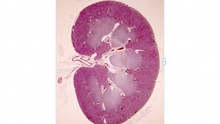 Repaso teórico  práctico histología del riñón [upl. by Aeki]