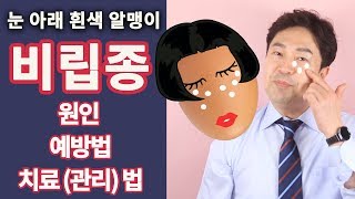 비립종 원인 예방법 치료방법 제거방법 깐달걀 눈가피부 만들기 by 핑피박 [upl. by Clarence]