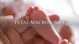 FETAL MACROSOMIA VERY LARGE BABY  USMLE NBME [upl. by Reffinnej]