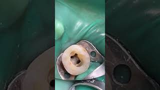 endodontist endodontics rootcanaltreatment rootcanaltherapy [upl. by Waldemar]