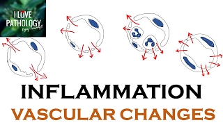 INFLAMMATION Part 1 General concepts types  Vascular changes in Acute inflammation [upl. by Cirdor]