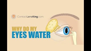 Why Do My Eyes Water What Causes My Eyes to Water [upl. by Osicnarf]