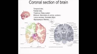 Coronal section of the Brain [upl. by Rebme]