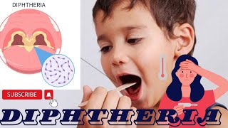 Diphtheria خناک کا مرضگلے کے امراض اور انکا علاج [upl. by Heffron]