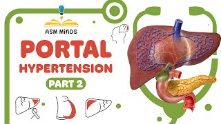 Portal Hypertension part 2 [upl. by Salvatore]