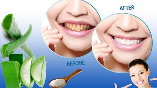 WHITE Teeth in 2024 Made Easy with This Proven Method [upl. by Artemisa]