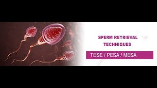 TESE SPERM PREPARATION ampicsi READY TO INJECTicsi maleinfertility azoospermia [upl. by Amles]