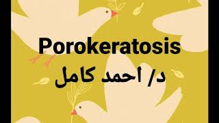 porokeratosis [upl. by Auohp681]