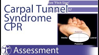 Carpal Tunnel Syndrome Diagnosis NCSEMG [upl. by Aretta]