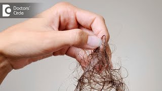 What are causes of severe hair fall like 100 strands daily  Dr Nischal K [upl. by Noryak404]